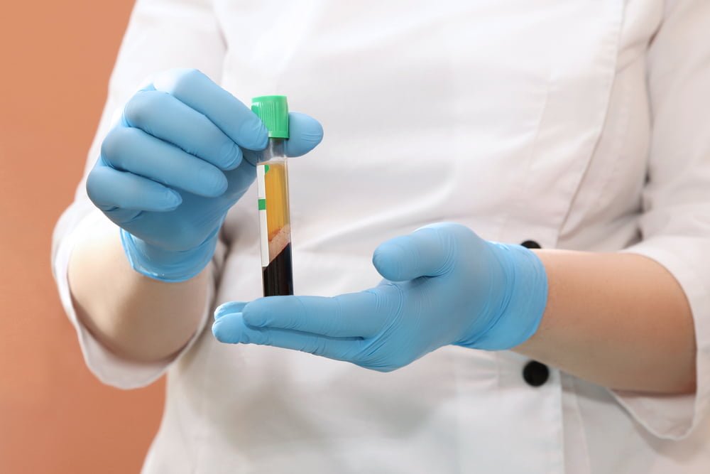 Platelet Rich Plasma (PRP) Therapy - A word from Dr. Matta_Meeting Point Health