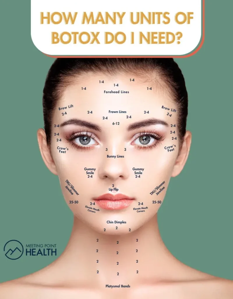 Deciphering Dosage How Many Units of Botox Do I Need